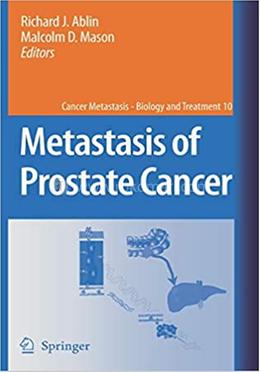 Metastasis of Prostate Cancer image
