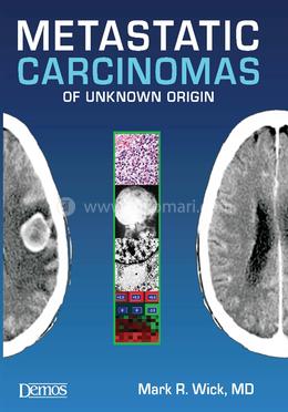 Metastatic Carcinomas of Unknown Origin image