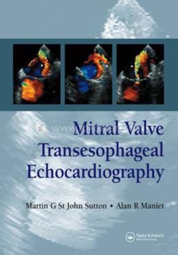 Mitral Valve Transesophageal Echocardiography image