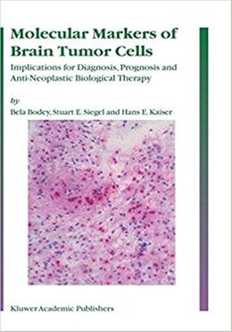 Molecular Markers of Brain Tumor Cells image