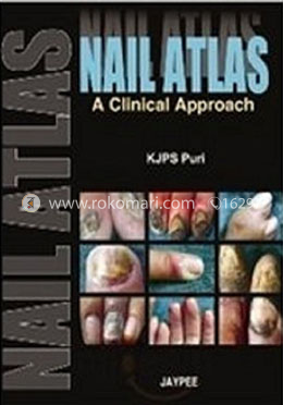 Nail Atlas: A Clinical Approach image