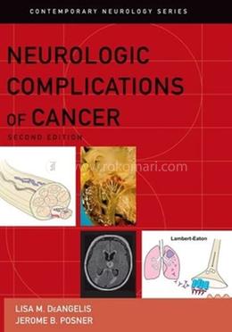 Neurologic Complications of Cancer: 73 (Contemporary Neurology Series) image