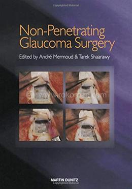 Non-Penetrating Glaucoma Surgery 