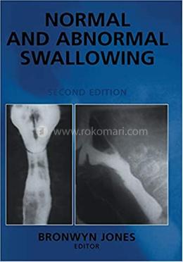 Normal and Abnormal Swallowing image