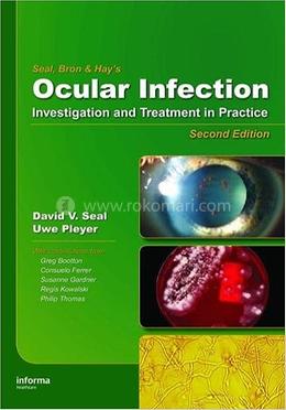 Ocular Infection image