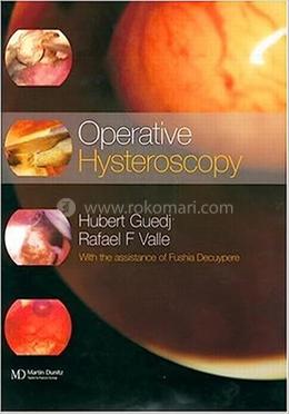 Operative Hysteroscopy image