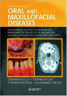Oral And Maxillofacial Diseases image