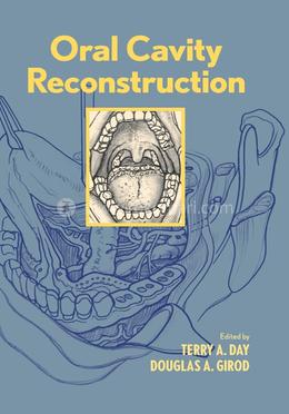 Oral Cavity Reconstruction image