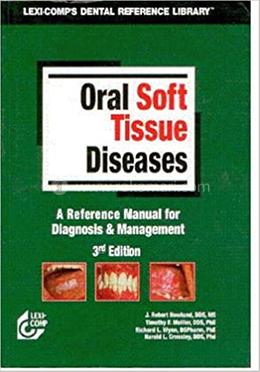 Oral Soft Tissue Diseases image