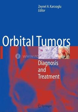 Orbital Tumors image