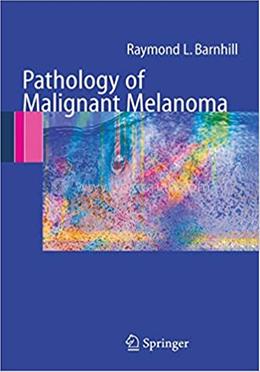 Pathology of Malignant Melanoma image