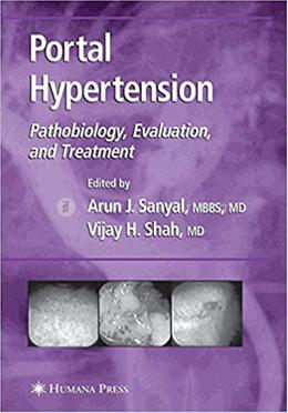 Portal Hypertension image