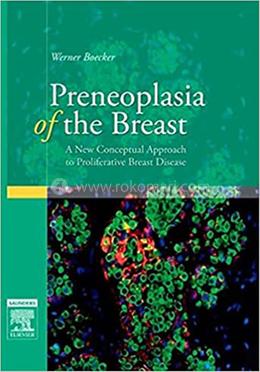 Preneoplasia of the Breast image
