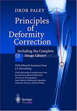 Principles Of Deformity Correction