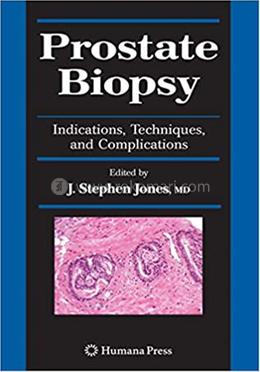 Prostate Biopsy image
