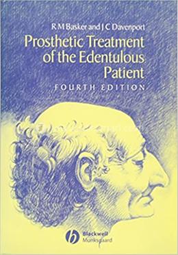 Prosthetic Treatment of the Edentulous Patient image