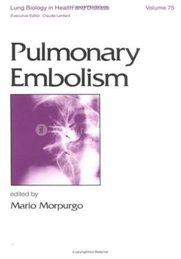Pulmonary Embolism image