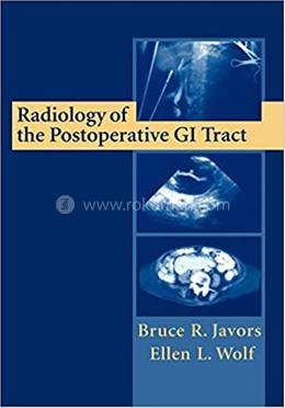 Radiology of the Postoperative GI Tract image