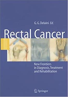 Rectal Cancer image