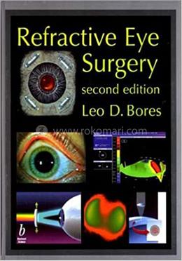 Refractive Eye Surgery image