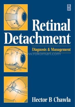 Retinal Detachment image