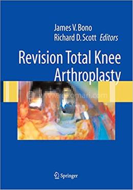 Revision Total Knee Arthroplasty image