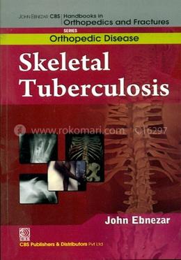 Skeletal Tuberculosis - (Handbooks in Orthopedics and Fractures Series, Vol. 33 : Orthopedic Diseases) image