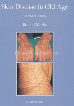 Skin Disease In Old Age image