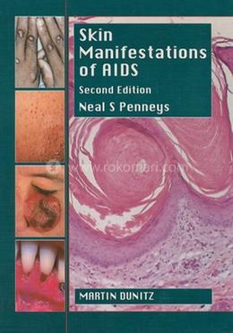 Skin Manifestations Of Aids image