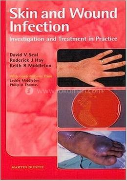 Skin and Wound Infection image