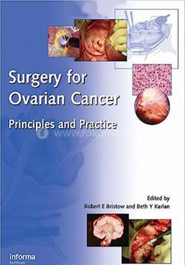 Surgery for Ovarian Cancer image