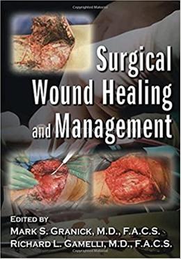 Surgical Wound Healing and Management image