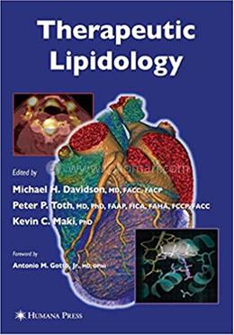 Therapeutic Lipidology image