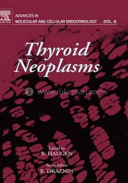Thyroid Neoplasms image