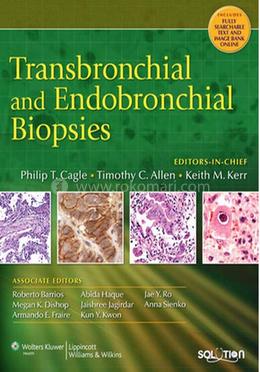Transbronchial and Endobronchial Biopsies image