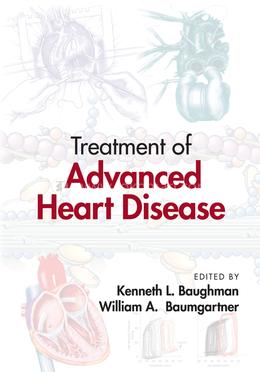 Treatment of Advanced Heart Disease image