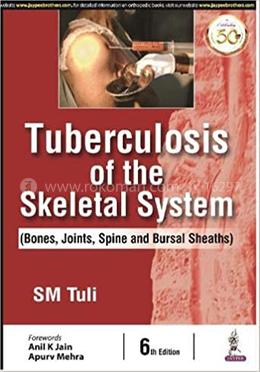 Tuberculosis Of The Skeletal System image