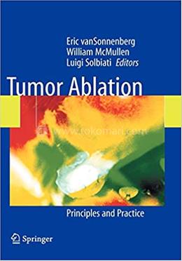 Tumor Ablation image