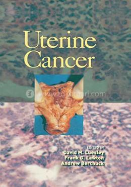 Uterine Cancer image