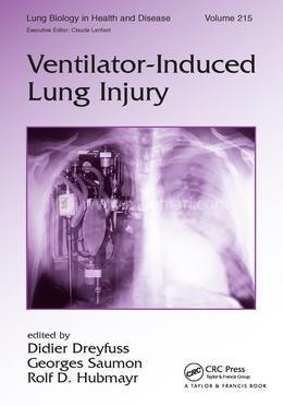 Ventilator-Induced Lung Injury image