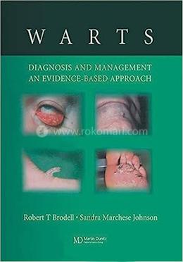 Warts: Diagnosis and Management image