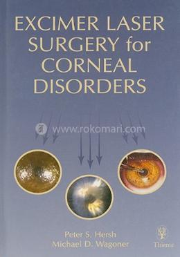 Excimer Laser Surgery for Corneal Disorders image
