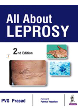 All About Leprosy image