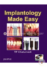 Implantology Made Easy (Paperback) image