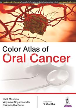 Color Atlas of Oral Cancer image
