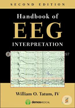 Handbook of EEG Interpretation image