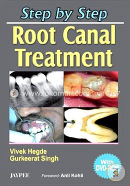 Step by Step Root Canal Treatment (with DVD Rom) (Paperback)