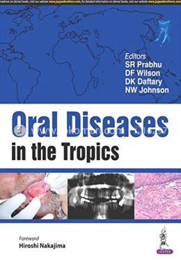 Oral Diseases in the Tropics image