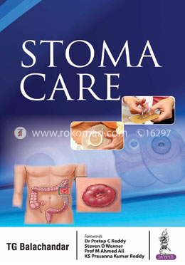 Stoma Care image