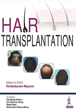 Hair Transplantation image